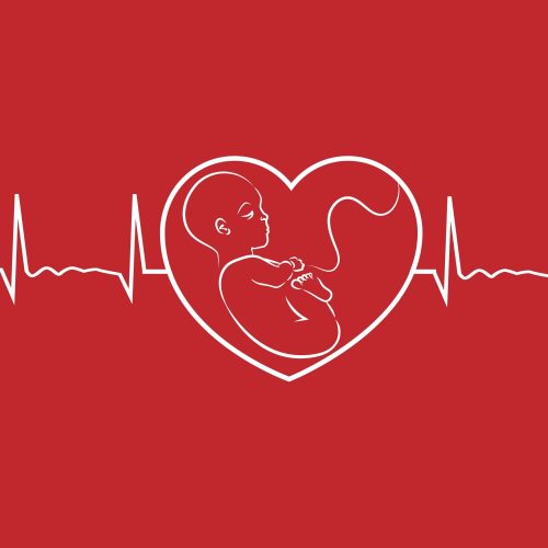 CTG - Cardiotocografie durante partu